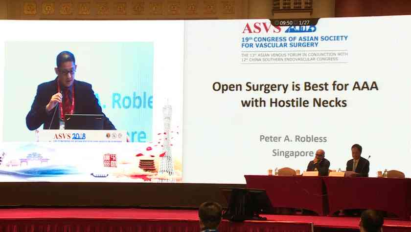 Peter：Open Surgery is Best for AAA with Hostile Necks